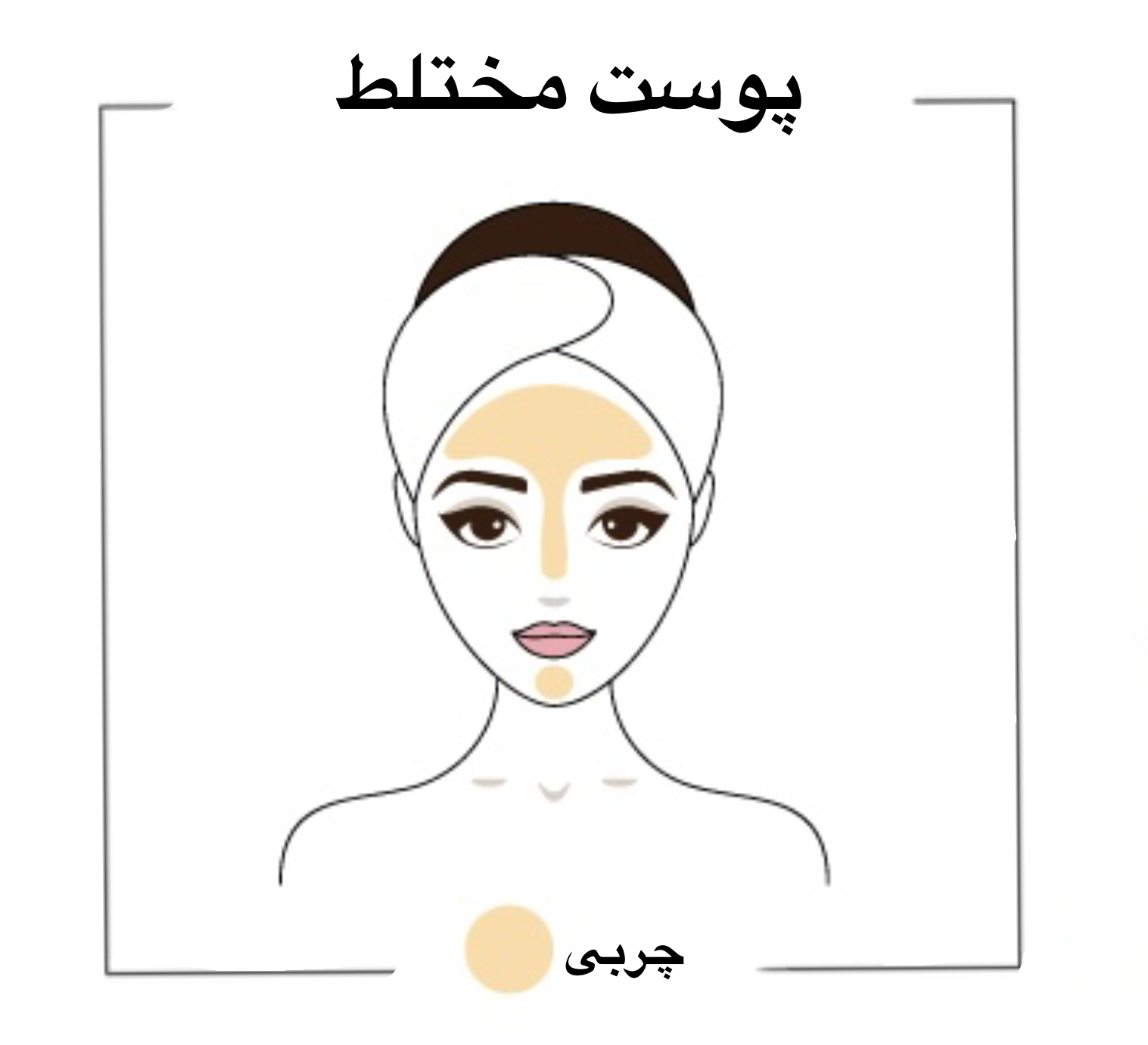 ویژگی پوست چرب