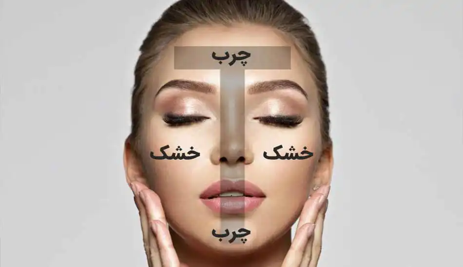 فیشال پوست مختلط